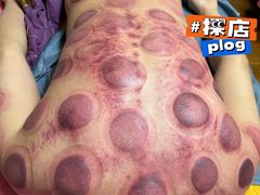 -沈师傅盲人按摩工作室(密三小区店)