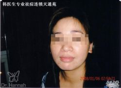 -韩医生专业祛痘连锁机构