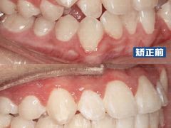 -优诺口腔(华东总院)