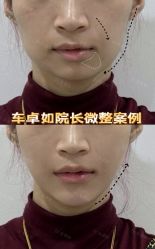 -Yestar重庆艺星医疗美容医院