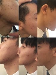 -皇族养心堂·净痘·修敏·御颜