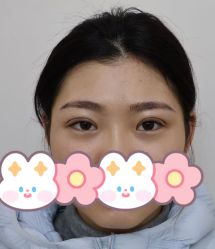 -天津健丽·去眼袋医疗美容机构