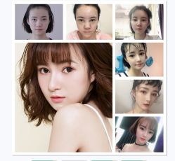 点击看大图 体验前-美莱医学美容医院