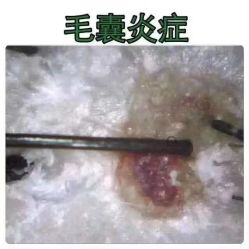 -曼都发型