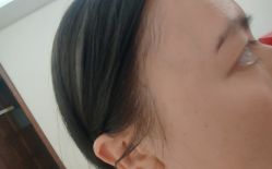 -长沙雅美医疗美容医院