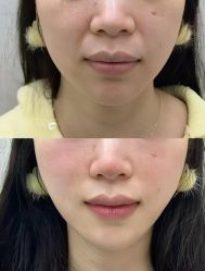 -深圳艺星医疗美容医院