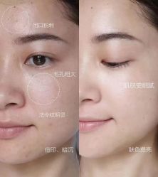 -痘庄科学祛痘国际连锁