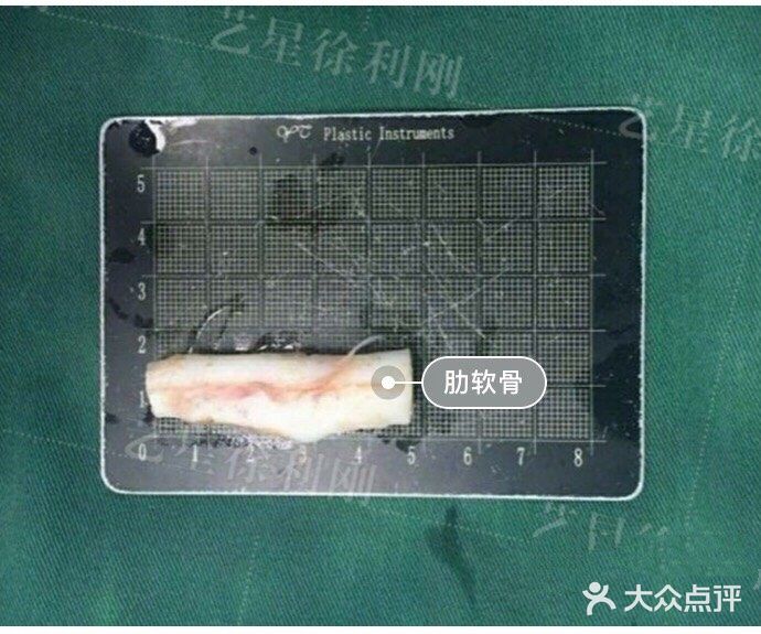 塌鼻子如何变立体？【案例详解】