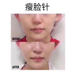 -E.beauty驻颜·痘敏肌调理中心