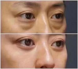 -睿明真达专业皮肤护理中心