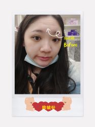 -伊丽莎白医疗美容