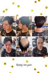 -发饰美男士增发补发假发定制店