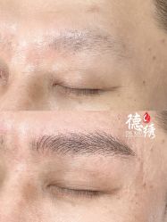 -德绣·机器野生眉发际线·美瞳线半永久