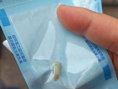 -极橙儿童齿科矫正中心(奥城店)
