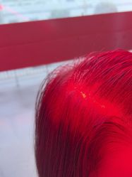 -碧莲盛·不剃发植发