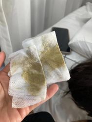 -SKIN79皮肤管理中心