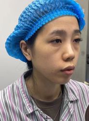 -天津健丽·去眼袋医疗美容机构