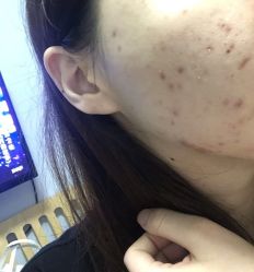 -晶禾臻语·问题肌研究所
