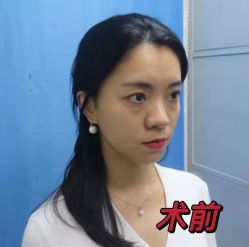-天津健丽·去眼袋医疗美容机构