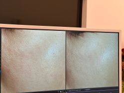 -苑苑vbeauty科技美容SPA