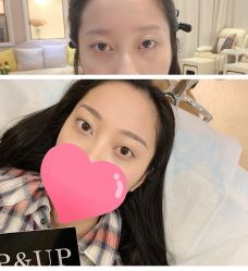 -UP&UP·半永久眉毛眼线机器野生眉