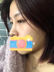 点击看大图 体验后-JUVA郑州欧华医疗美容医院
