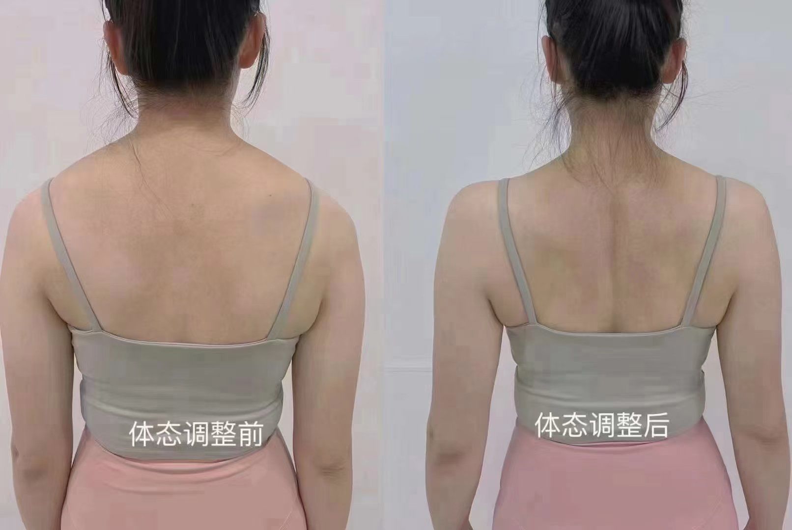 圆肩驼背调整对比图 想改变就先开始