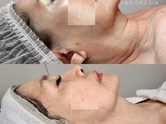 -证大大拇指广场(芳甸路店)