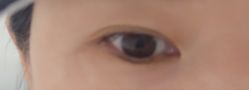 -广州美莱医疗美容医院