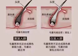 -希梵尔头皮抗衰·科技养发