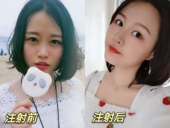 -河南中医药大学第一附属医院-医疗整形