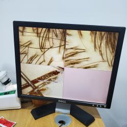 -章光101防脱养发荟