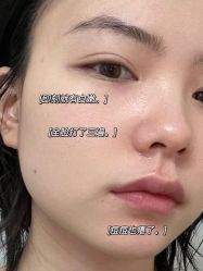 -叶美人医疗美容