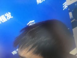 -雍禾植发全国连锁