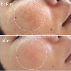 -E.beauty驻颜·痘敏肌调理中心