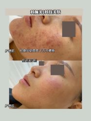 -美肤盾祛痘·问题肌头疗管理中心