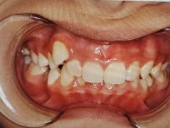 -宁波儿童口腔医院(钱湖院区)