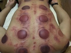 -御筋堂正骨推拿(星源国际店)