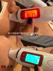 -觅屿日式脱毛美肤