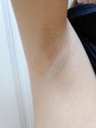 点击看大图 体验后-天津伊美尔医疗整形美容专科医院