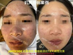 -元熙兰积皮肤管理