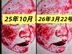 -和颜一美轻医美连锁