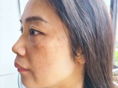 -上海爱以德护理院·康复(宝山院)