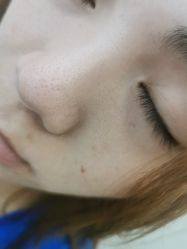 体验前-恒妍医美·韩国定制抗衰中心