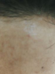 -蕾特恩专业祛痘·皮肤管理