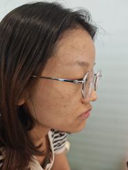 -长沙雅美医疗美容医院