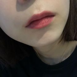-瑞尼丝国际专业脱毛连锁