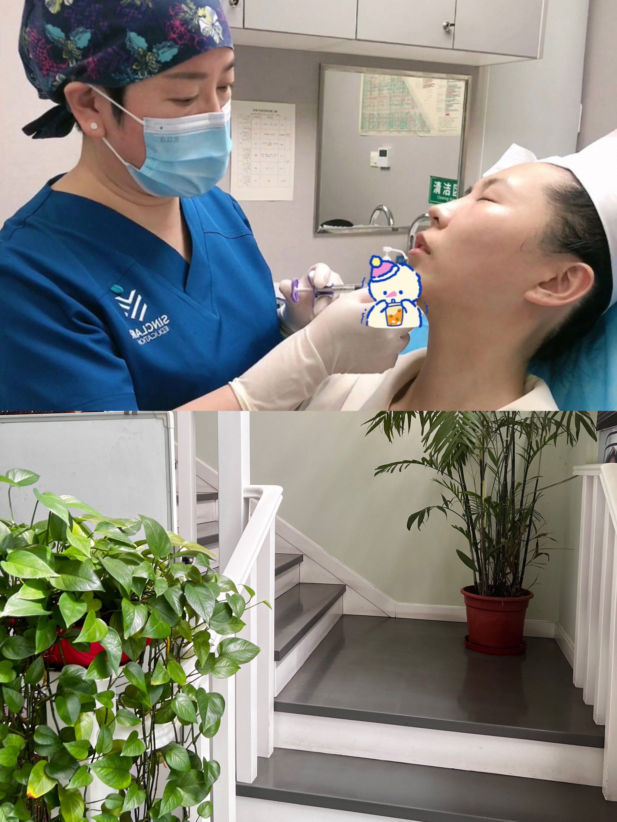 玻尿酸下巴补针