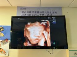 -杭州贝瑞斯美华妇儿医院·早孕·产检·儿科