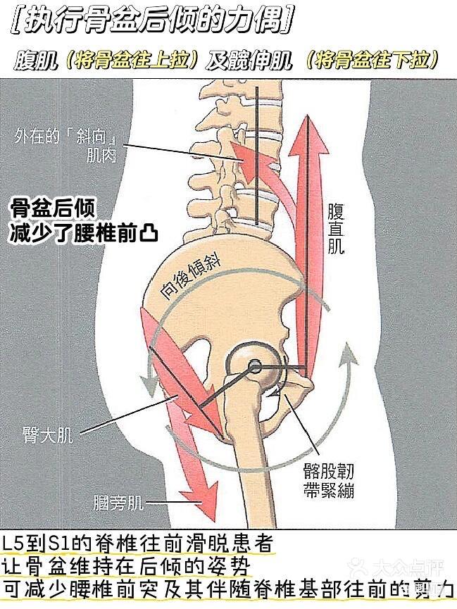骨盆后倾的危害图片